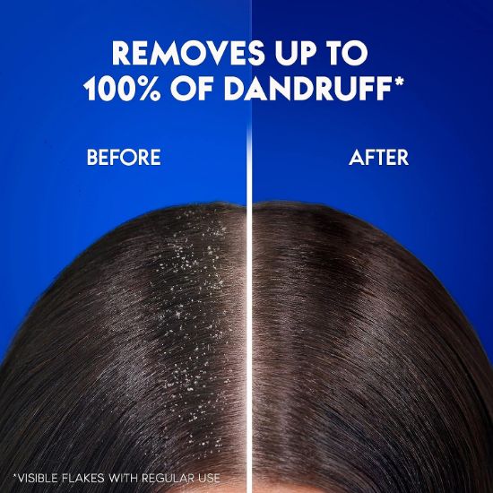 صورة  هيد اند شولدرز شامبو  سموث اند سيلكي مضاد للقشرة 200 مل