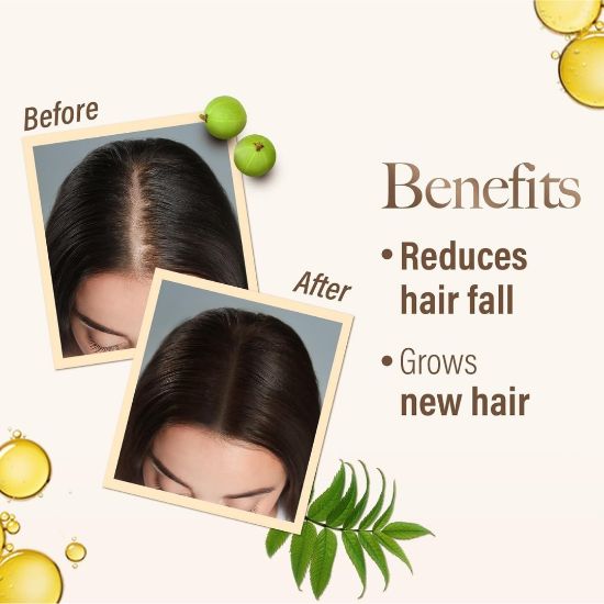 صورة زيت الايورفيدا لعلاج فروة الرأس والشعر من كيش كينج 300 مل