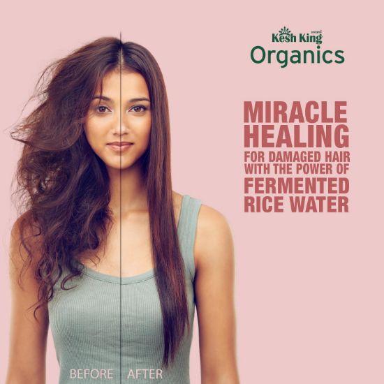صورة شامبو ماء الأرز المخمر-كيش كينج اورجانيكس يغذي ويصلح الشعر للحصول على شعر نطاط الخالي-الهيشان عضوي معتمد بدون ألوان صناعية أو بارابين فثالات مواد كيميائية ضارة 300 مل